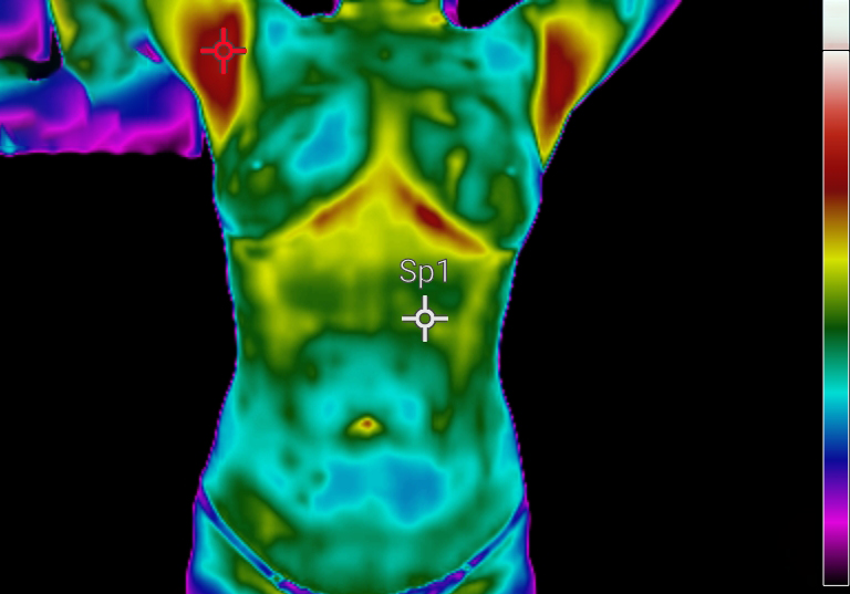 Câmeras Termograficas Para Saúde
